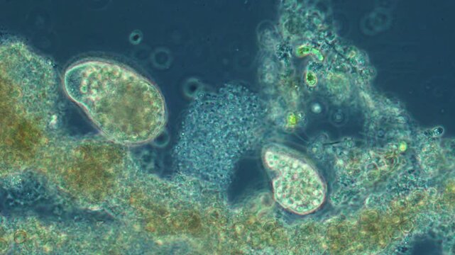 Large ciliates move in the liquid among bacteria and plant debris.