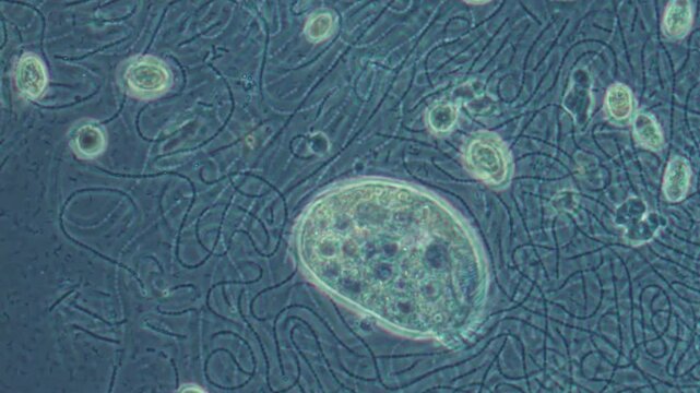 Large microorganism moving among filamentous bacteria in liquid, magnified under microscope.