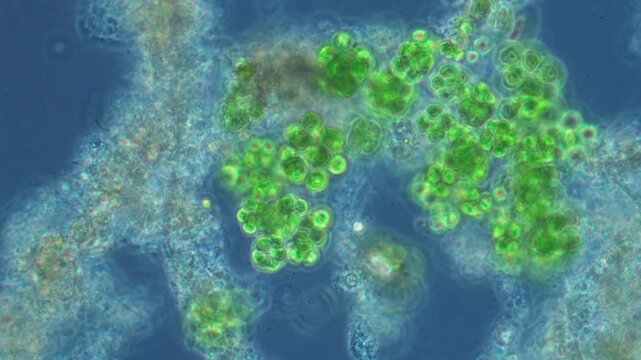 A colony of living green algae under microscope magnification.