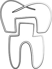 Tooth with Crown – Schematic representation of a tooth with a crown installed.