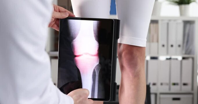 Physician holds X-ray image of patient knee joint comparing with real bones. Doctor uses advanced medical technology to take precise picture of joint