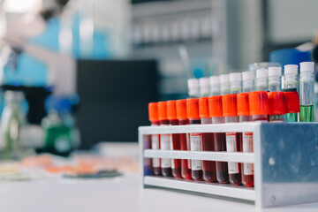 Team Asian scientists in a lab conducting food research using a microscope and lab equipment, showcasing innovation in food science and biotechnology