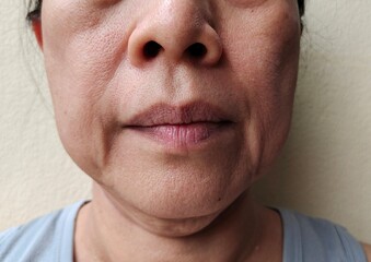 portrait the wrinkle and Flabby skin beside the mouth, Flabbiness and loose, dark spots and blemish on the face, health care and beauty concept.