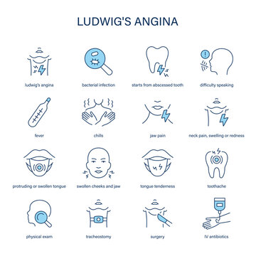 Ludwig's Angina symptoms, diagnostic and treatment vector icon set. Medical icons.