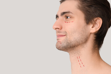 Obraz premium Young man with marked face on light background, closeup. Plastic surgery concept