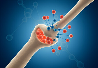 3D Rendered Nanomachines Restoring Bone Density - Osteoporosis Treatment Image