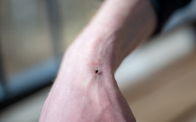 Fototapeta premium tick walking on the hand. It is a dangerous arachnid that is a carrier of many pathogens