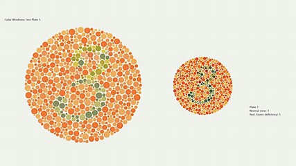 Ishihara Color vision test or Color Blindness Test Plate 7, Normal vision 3, Red Green deficiency 5. © A.S.Khan