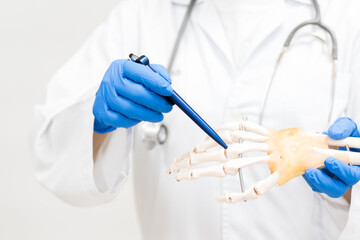 Orthopedist explain to the patient for human hand and fingers bone injury treatment program.Doctor...