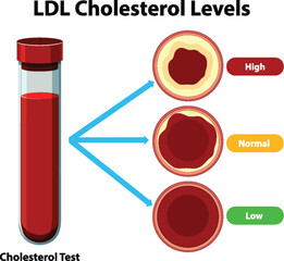 Understanding LDL Cholesterol Levels