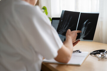Traumatologist pointing at radiography, examining hand x-ray after trauma incident, providing...