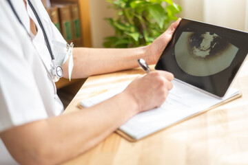 Female doctor in white coat with stethoscope is writing notes on clipboard while examining ultrasound scan displayed on tablet computer, focusing on healthcare and medical diagnosis