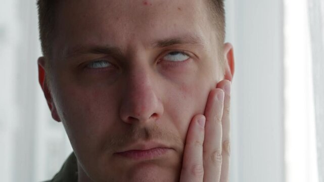 Strabismus in a person.
A man has vision problems.
Pupils look in different directions.
Treatment of strabismus in a guy