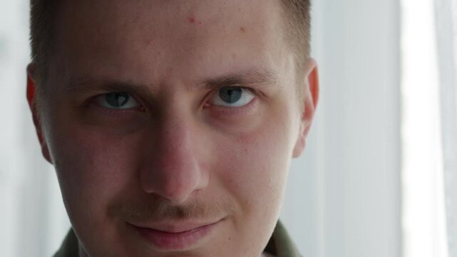 Strabismus in a person.
A man has vision problems.
Pupils look in different directions.
Treatment of strabismus in a guy