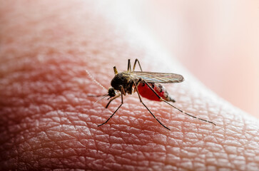 Malaria Infected Mosquito Bite. Leishmaniasis, Encephalitis, Yellow Fever, Dengue, Malaria Disease, Mayaro or Zika Virus Infectious Culex Mosquitoe Parasite Insect Macro.