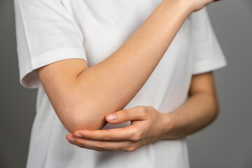 woman has a red mark on her elbow, Caused by itching due to insect stings or chemical allergies