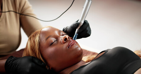 Black woman gets skin microneedling in beauty clinic