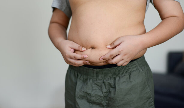 A fat child with a fat belly holds his stomach with his hands.