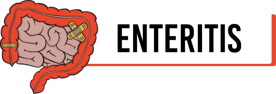 enteritis