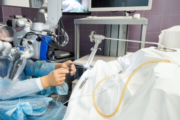 Process of surgery operation using laparoscopic equipment and laser. Group of surgeons in operating...