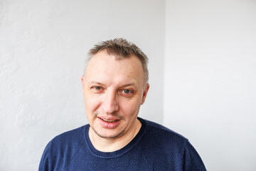 Obraz premium face of angry person dissatisfied with life and everything that happens. man is grimacing