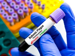 Blood sample for Bubonic plague test. It's one of three types of plague caused by the bacterium...