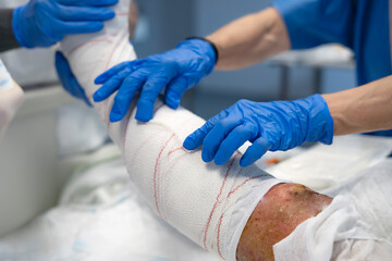 Doctors applying bandage on patient's injured leg in hospital operating room