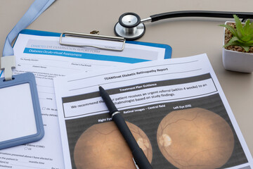 Eye and Vision Assessment Report on Doctor’s Table for Diabetics