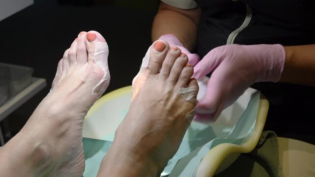 Pedicurist applies pads soaked in express softener to the soles of client's feet to soften and remove calluses and rough skin on feet for fast and effective callus removal,