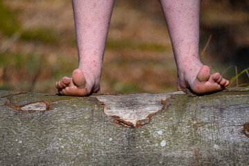 A person is walking barefoot on a fallen tree trunk in the woods, connecting with nature and...