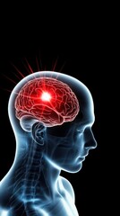 Obraz premium Human head with an X ray showing the brain highlighted in red, illustrating stroke diagnosis, Stroke recovery, recovery therapy, headache, head pain