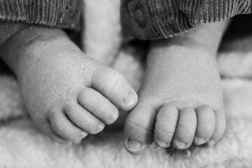 Baby feet black and white 