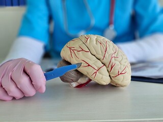 Concept of brain surgery or neurosurgery. Neurosurgeon holding scalpel in hand over 3D anatomical model of human brain