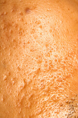 Close-Up of Skin Texture with Pores and Natural Patterns