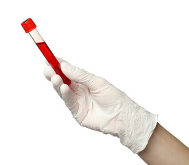 Doctor in medical glove holding test tube with blood sample on white background, closeup