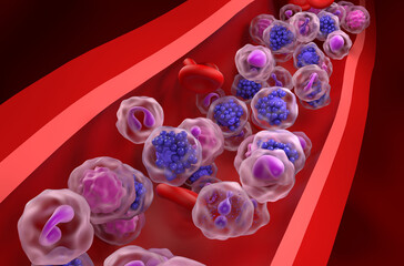 Diffuse large B-cell lymphoma (DLBCL) - closeup view 3d illustration
