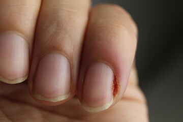 three fingers of the hand close-up. Hand Care