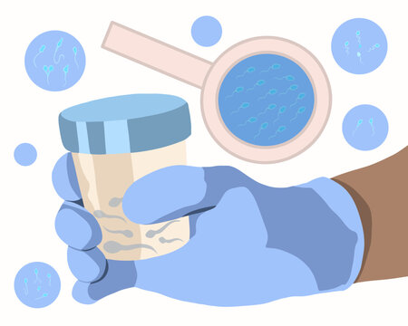 Vector isolated illustration of sperm defects. Spermogram. Laboratory examination of sperm.