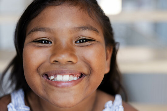 Smiling girl with missing teeth enjoying sunny day at poolside