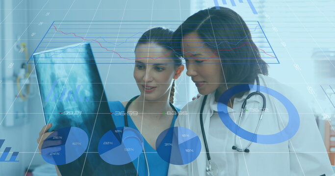 Statistical data processing against female doctor and health worker examining xray report
