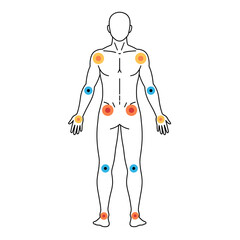 Body Pain Points: A comprehensive medical illustration displaying highlighted pain points on a human figure, emphasizing key areas affected by ailments.
