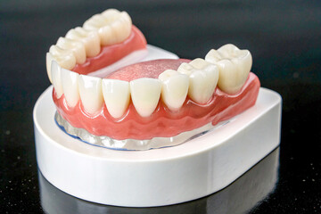 Obraz premium Dental Model with Realistic Teeth and Pink Gums for Education