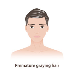 Premature graying is hair problems for men illustration. The man with early loss of natural hair color, before the age of 30, can be influenced by genetics, ethnicity, lack of vitamin and mineral.