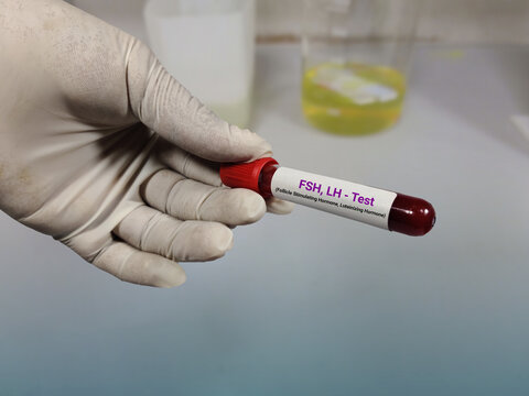 Doctor holds Blood sample for FSH, LH (Follicle Stimulating Hormone, Luteinizing hormone) test with laboratory background. Closeup. Sex Hormone.		