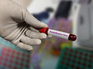 Doctor holds blood samples for Parainfluenza Virus test in the laboratory background.