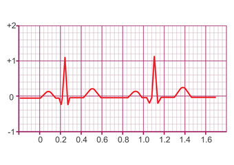 Electrocardiogram ( ECG or EKG signal).