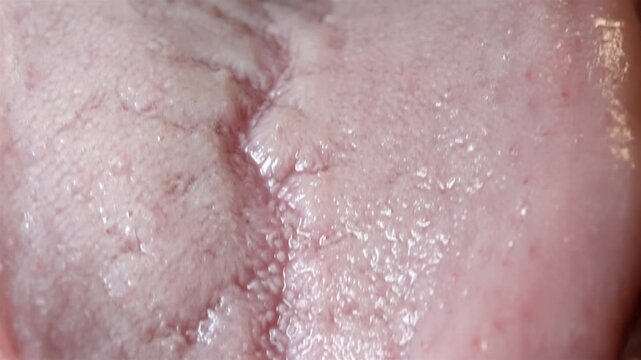 A detailed close-up of a tongue, showcasing its texture and intricate surface features.