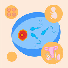 Artificial insemination. In vitro fertilization. Egg freezing. Sperm donation. Egg donation. Sperm freezing. Fertility clinic. Vector isolated illustration of fertilization process.