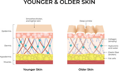 Younger vs Older Skin A Comparison of Skin Structure and Aging Vector Illustration