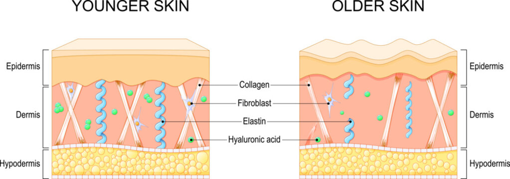 Aging skin chages. Wrinkle formation